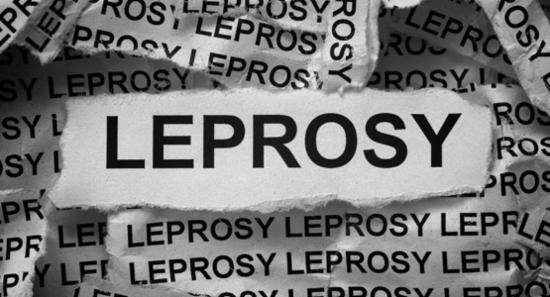 1,500 Leprosy Cases Reported Last Year